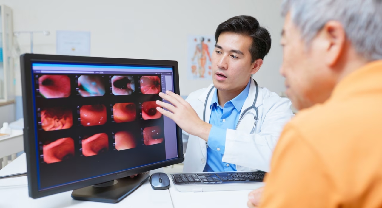 Cancer de l'estomac : les scientifiques alertent sur une bactérie très répandue mais souvent ...